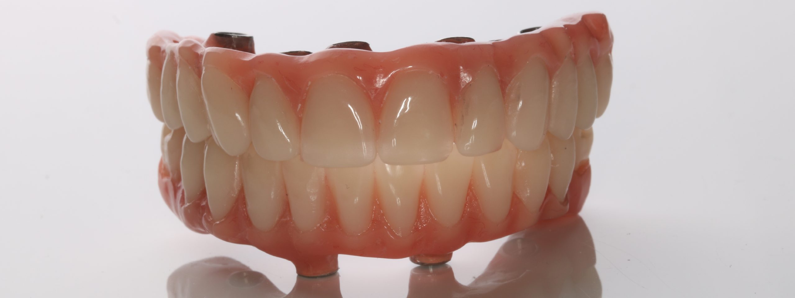 Prótesis de acrílico